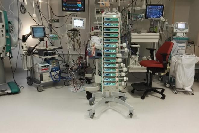 ECMO-sali kaikkine laitteineen muistuttaa galaktisen avaruusaluksen ohjaamoa. Keskellä etualalla oleva tornimainen kone toimii keinotekoisina keuhkoina, eli se happeuttaa hiilidioksidipitoisen veren ja palauttaa sen takaisin potilaan verenkiertoon. Kuva: Jukka Tähtinen