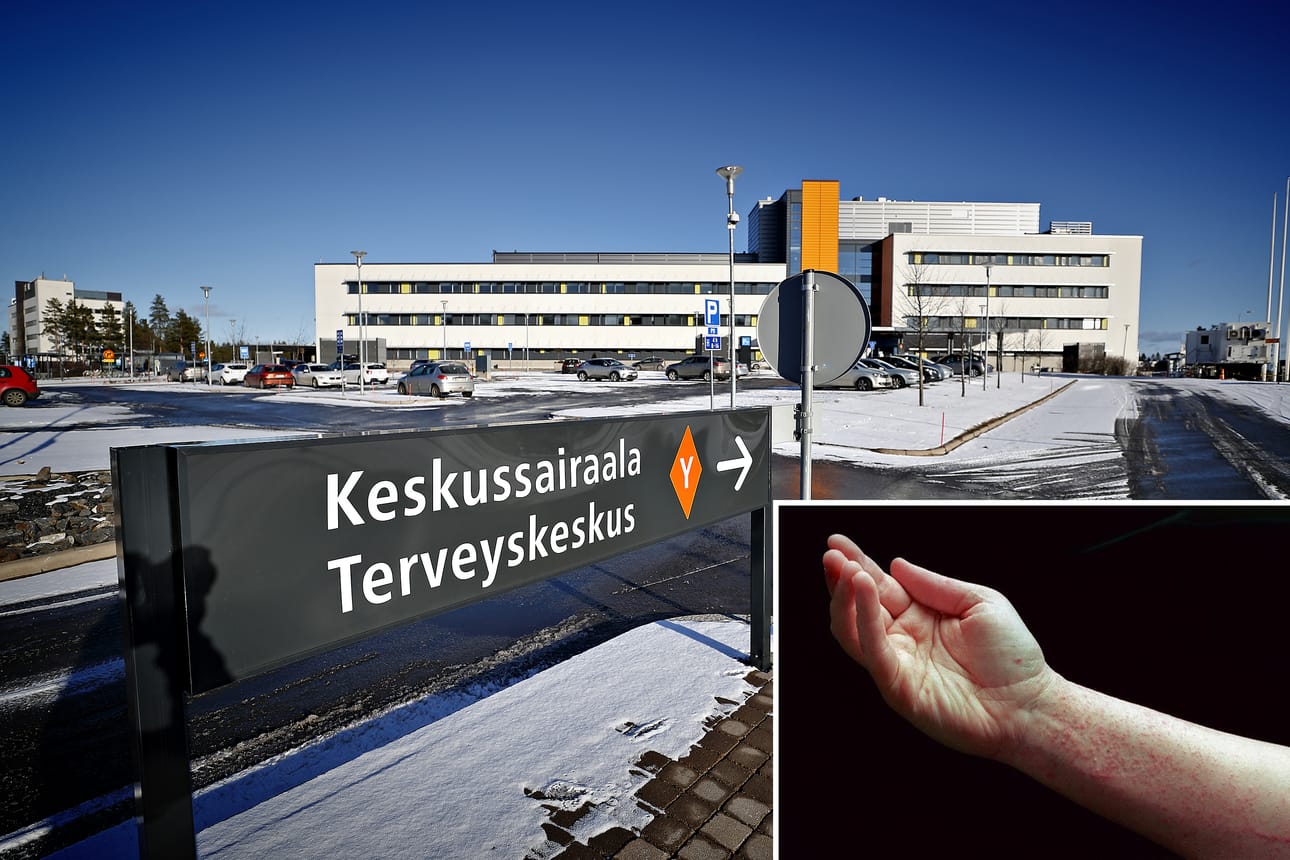 Seinäjoen keskussairaalassa on neljä ihotautien erikoislääkärin virkapohjaa. Arkistokuva.