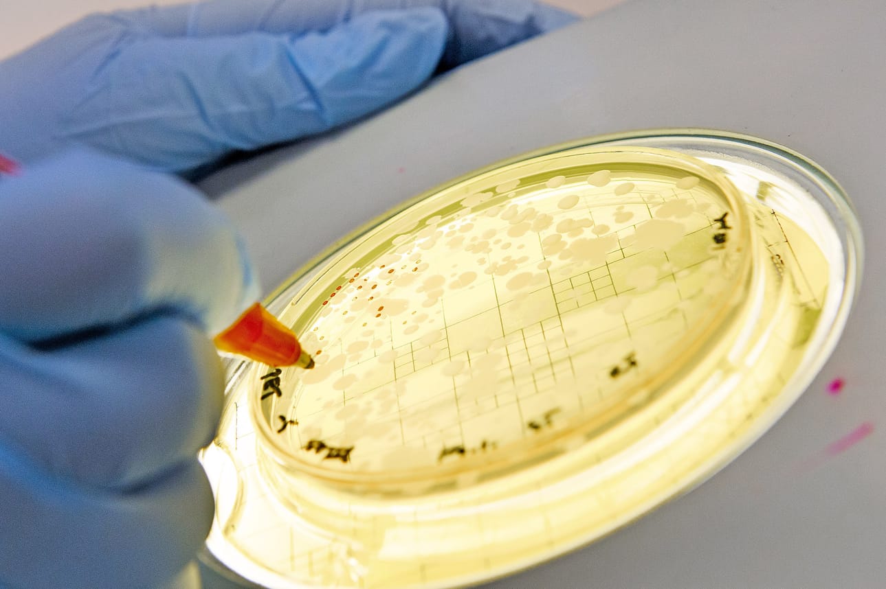 Turun yliopiston funktionaalisten elintarvikkeiden kehittämiskeskus testasi Lännen Median pyynnöstä, mitä probiootteja tuotteet oikeasti sisältävät.