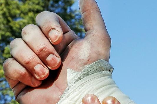 Valtimohaavoissa on tärkeintä tyrehdyttää verenvuoto, ja paineside on siihen hyvä ensiapu. Haavan päälle saadaan sopiva paine, kun ensimmäisten sidekerrosten päälle laitetaan esimerkiksi tulitikkuaski. KUVA: PEKKA AHO