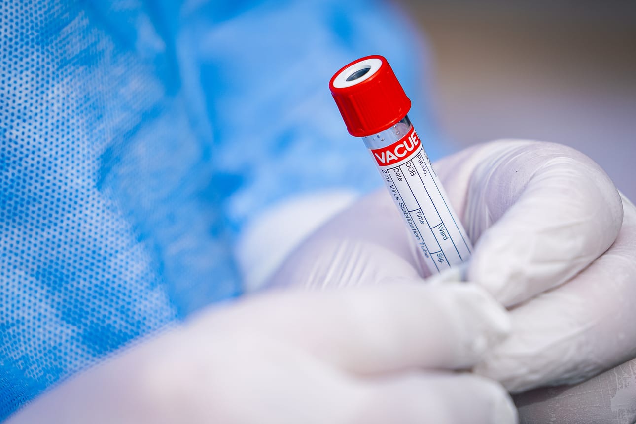 Positiivisten koronatestien määrä on noussut. Arkistokuva.