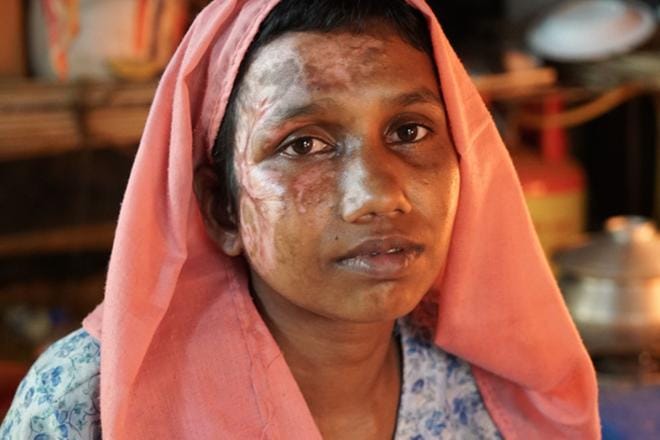 Bangladeshiin paenneet kertovat julmuuksista. Mumtaz Begum pääsi pakenemaan sotilaiden tuleen sytyttämästä rakennuksesta. KUVA: Yle Kuvapalvelu