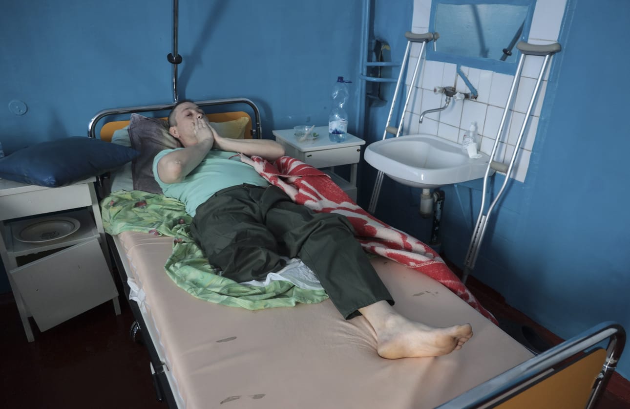 Sodan kasvoja: ukrainalainen siviili makasi maanantaina sairaalassa Harkovassa, jota Venäjän joukot ovat moukaroineet jatkuvasti sodan alettua. Mies menetti jalkansa ilmaiskujen seurauksena, kerrotaan kansainvälisen uutiskuvan tiedoissa.