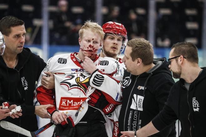 Vaasan Sportin hyökkääjä Aleksi Ainali loukkaantui rajussa törmäyksessä keskiviikkona Tampereella. KUVA: MIKA KANERVA