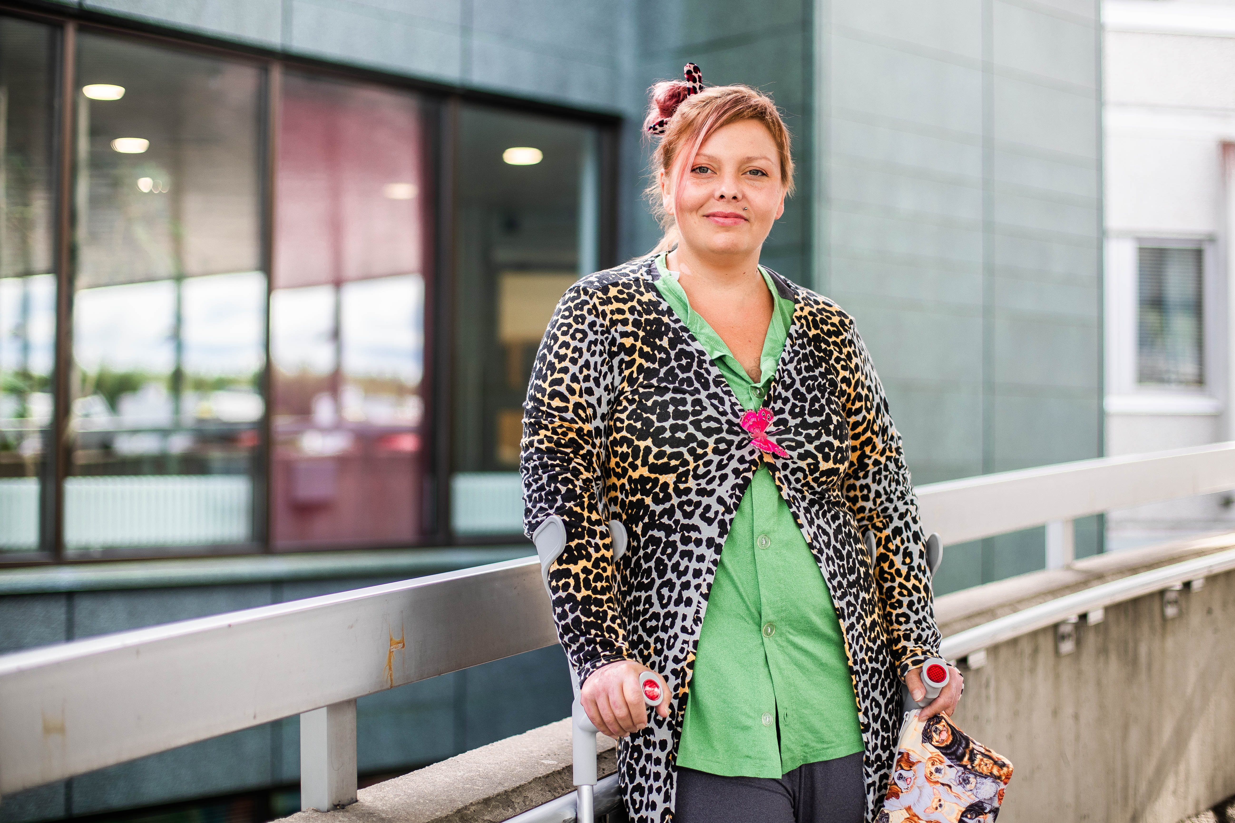 Jessica Aschberg pelasti koiriaan palavasta talosta, kunnes kuisti romahti – Kehossa satoja lasinsiruja ja palovammoja