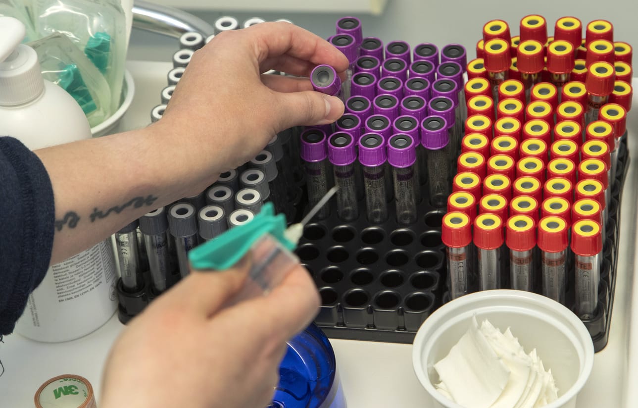 Laboratoriopalveluja tarjoavan Nordlabin pitää säästää yli kolme miljoonaa euroa tämän ja ensi vuoden aikana.