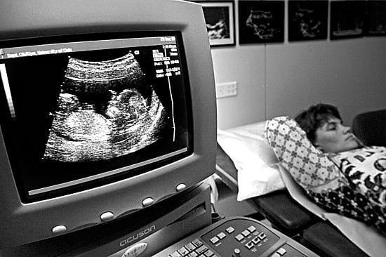 Tutkimustieto vahvistaa sen, minkä lapsia hoitavat ovat aina tienneet: äidin vatsassa asustelevat sikiöt oppivat monia asioita