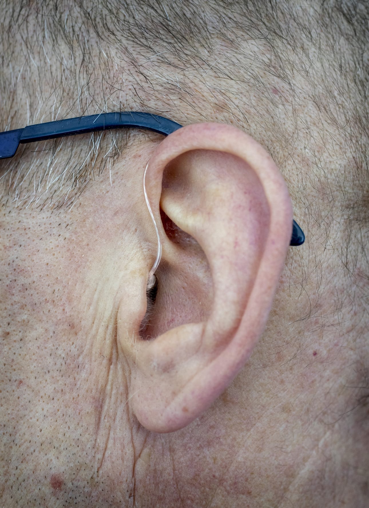 Induktiosilmukka siirtää äänen suoraan kuulolaitteeseen ja hyvin toimiessaan se tarjoaa selkeän ja laadukkaan kuulemisen kokemuksen.