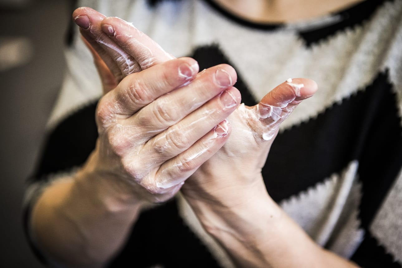 Talvikuivat kädet kiristävät, hilseilevät ja halkeilevat. Käsiä kannattaa rasvata useita kertoja päivässä, jos mahdollista. Ulkona paras pakkassuoja ovat hansikkaat.