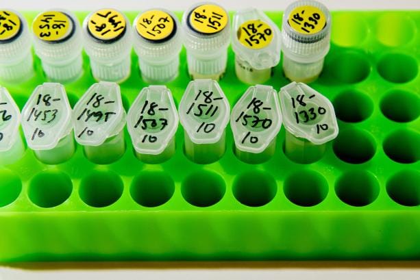 Geenitietoja voidaan käyttää erityisesti ihmisen terveydentilan ja sairastumisriskin arvioinnissa. KUVA: JUKKA-PEKKA MOILANEN