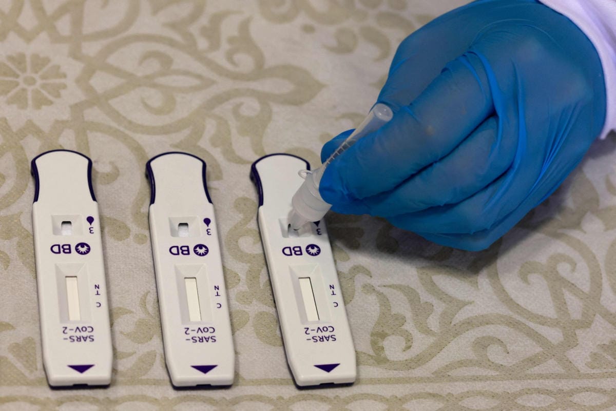 FDA:n mukaan alustava data osoittaa antigeenitestien kyllä tunnistavan omikronmuunnosta, mutta kyky havaita luotettavasti kaikki positiiviset näytteet saattaa olla heikentynyt. LEHTIKUVA / AFP