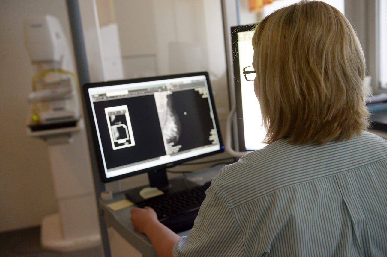 Maksuttomaan syöpäseulontaan kannattaa osallistua.