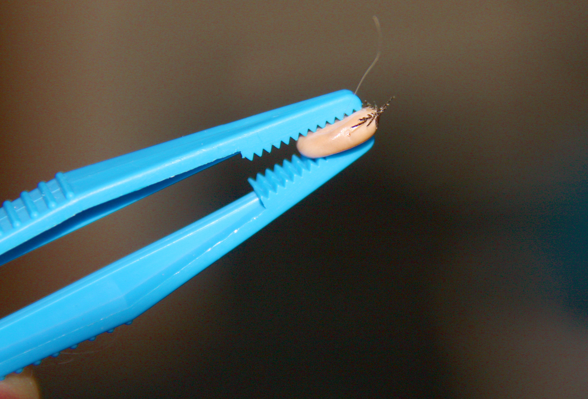 Koulujen punkkiohjeista liikkunut väärää tietoa Oulussa – Pohde: kouluterveydenhoitaja saa poistaa punkin oppilaasta