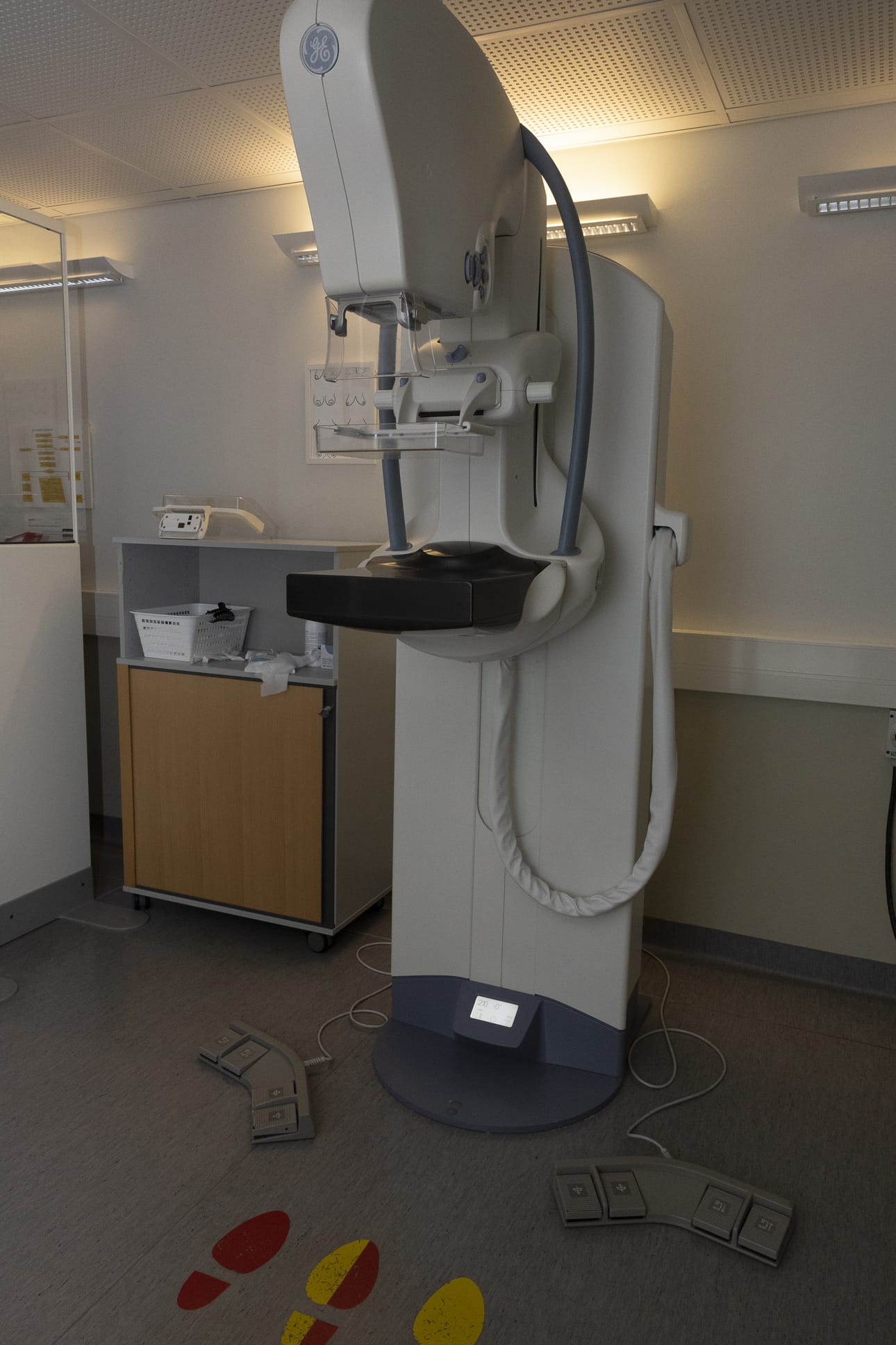 Mammografiakuvauslaite on erikoisröntgenlaite, joka on suunniteltu erityisesti rintakudoksen kuvantamiseen.
