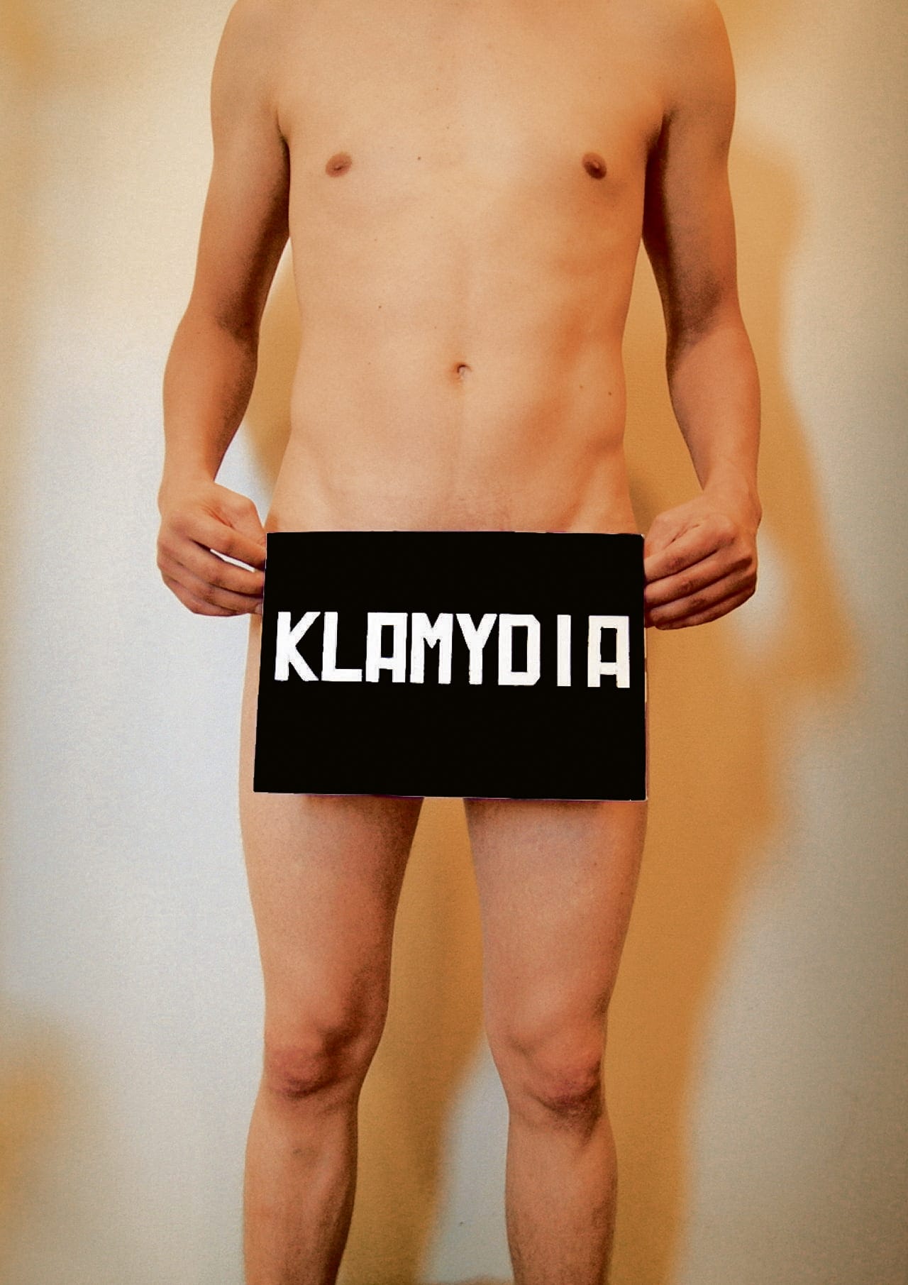 Miehistä puolet sairastaa klamydian oireettomana.