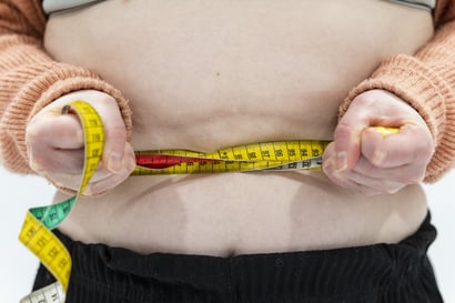 Oulussa puhuva syömishäiriöklinikan johtaja haluaa lisää keskustelua laihduttamisesta – Kehopositiivisuuden hän hylkäisi, koska sekin viittaa lihavuuteen