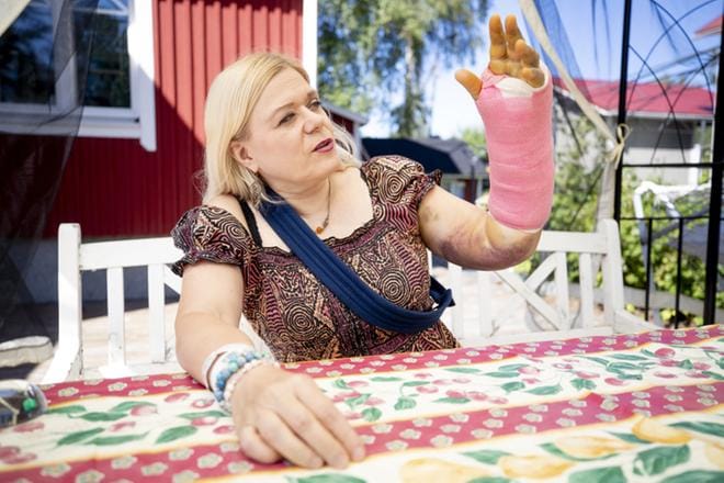 Heli Karhumäki kaatui sähköpotkulaudalla, kun pohja jäi kiinni katukivetykseen. Kuvat: Jaakko Elenius
