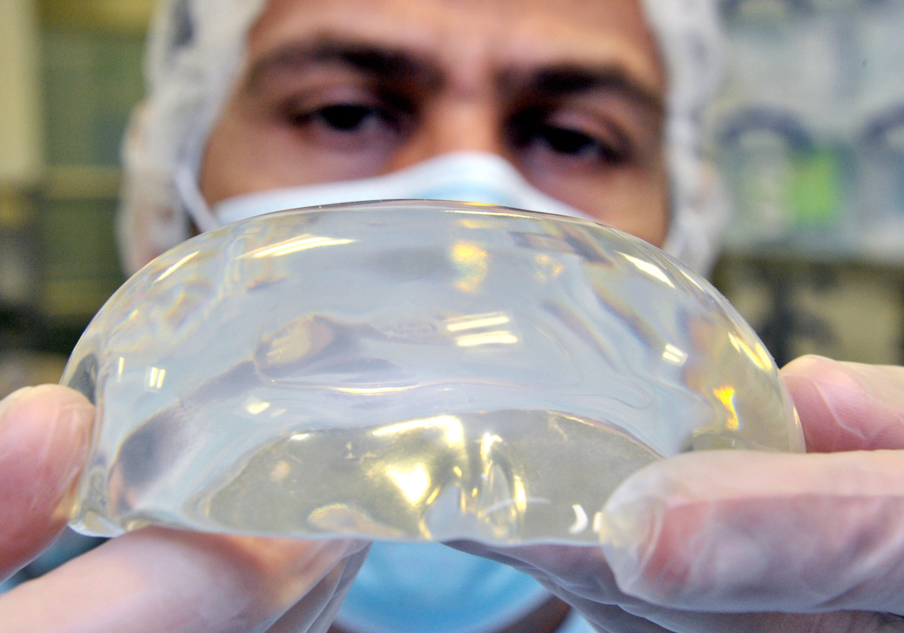 Rintaimplantit ovat aiheuttaneet terveyshaittoja useille naisille. Allerganin implantteihin voi liittyä syöpäriski. Kuvassa plastiikkakirurgi tarkistamassa silikoni-implantin kuntoa.
