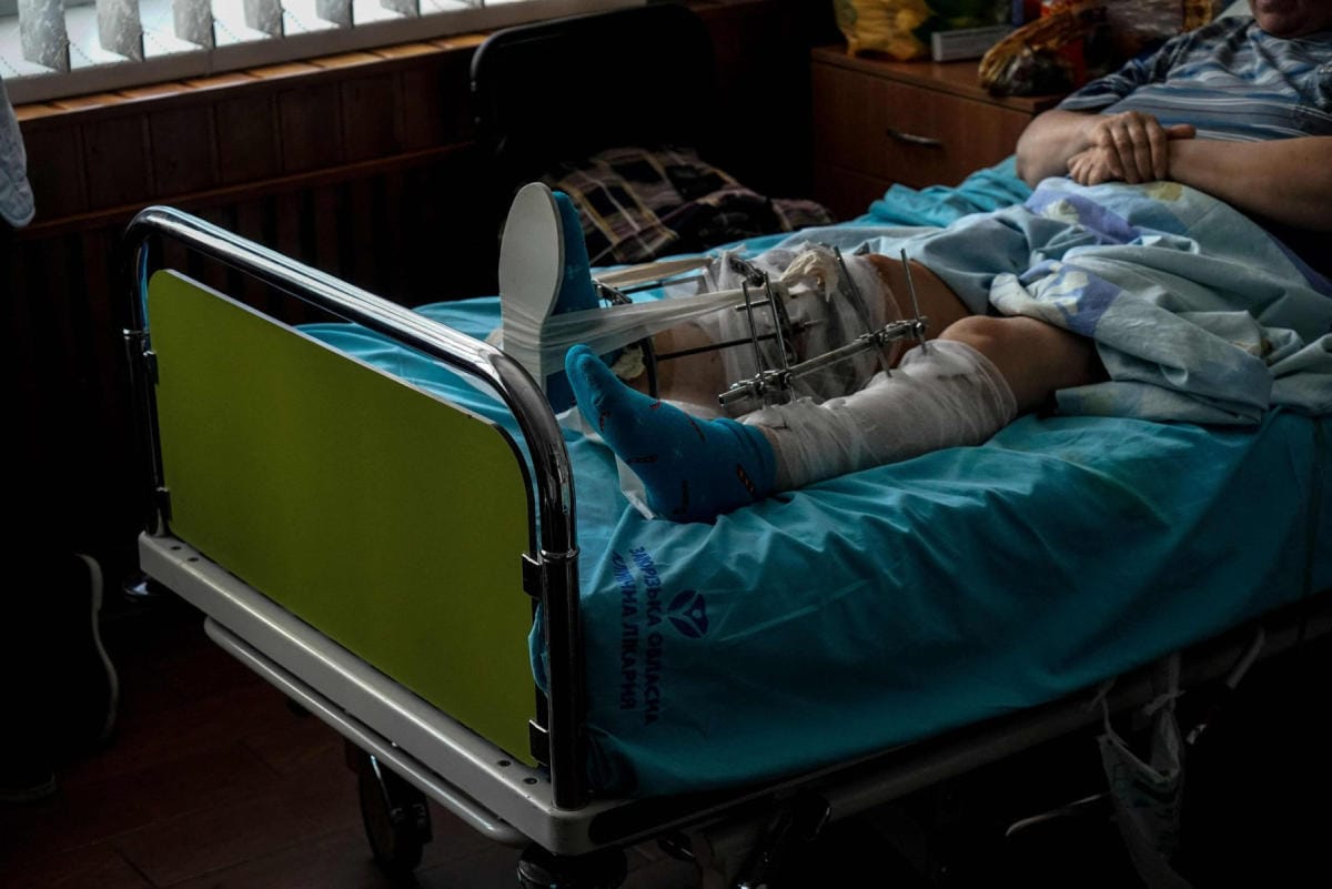 Sota Ukrainassa osuu raskaasti siviileihin. Loukkaantunut ukrainalaisnainen sairaalahoidossa Zaporizhzhjan kaupungissa. LEHTIKUVA / AFP