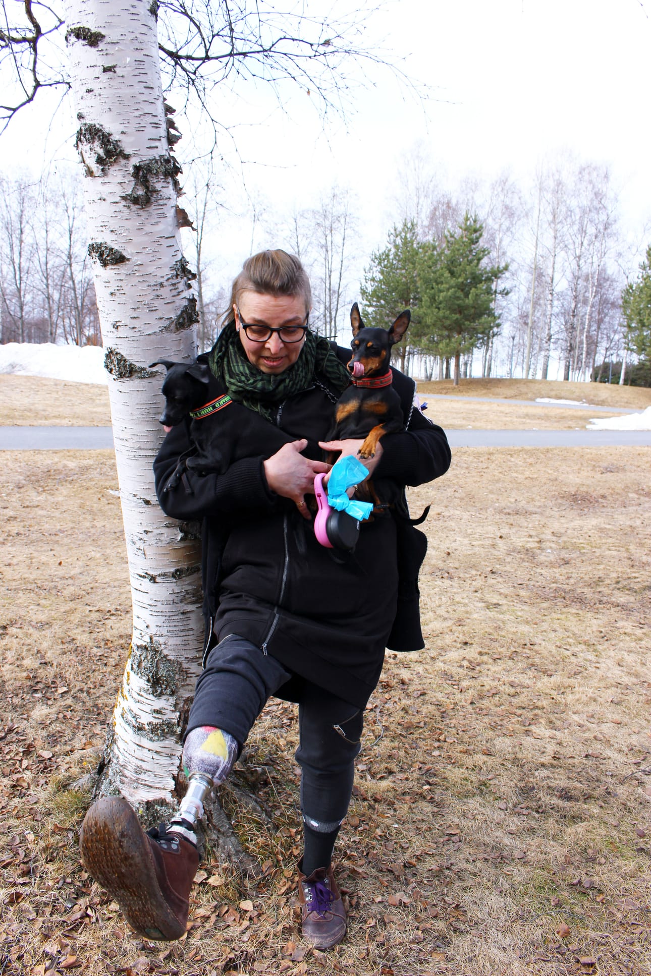 Päivi ei enää ujostele proteesiaan, vaan voi näyttää sitä kiinostuneille.