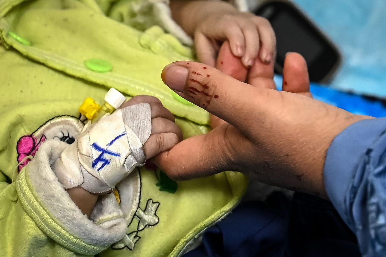 Osa perheistä matkustaa satoja kilometrejä Heratin sairaalaan, jossa toimii Lääkärit ilman rajoja -järjestö. Afganistanissa monilla alueilla ei ole mahdollisuutta hoitaa aliravitsemusta.