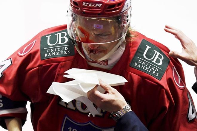 HIFK:n Iikka Kangasniemi sai kiekon kasvoihinsa. KUVA: LEHTIKUVA / VESA MOILANEN