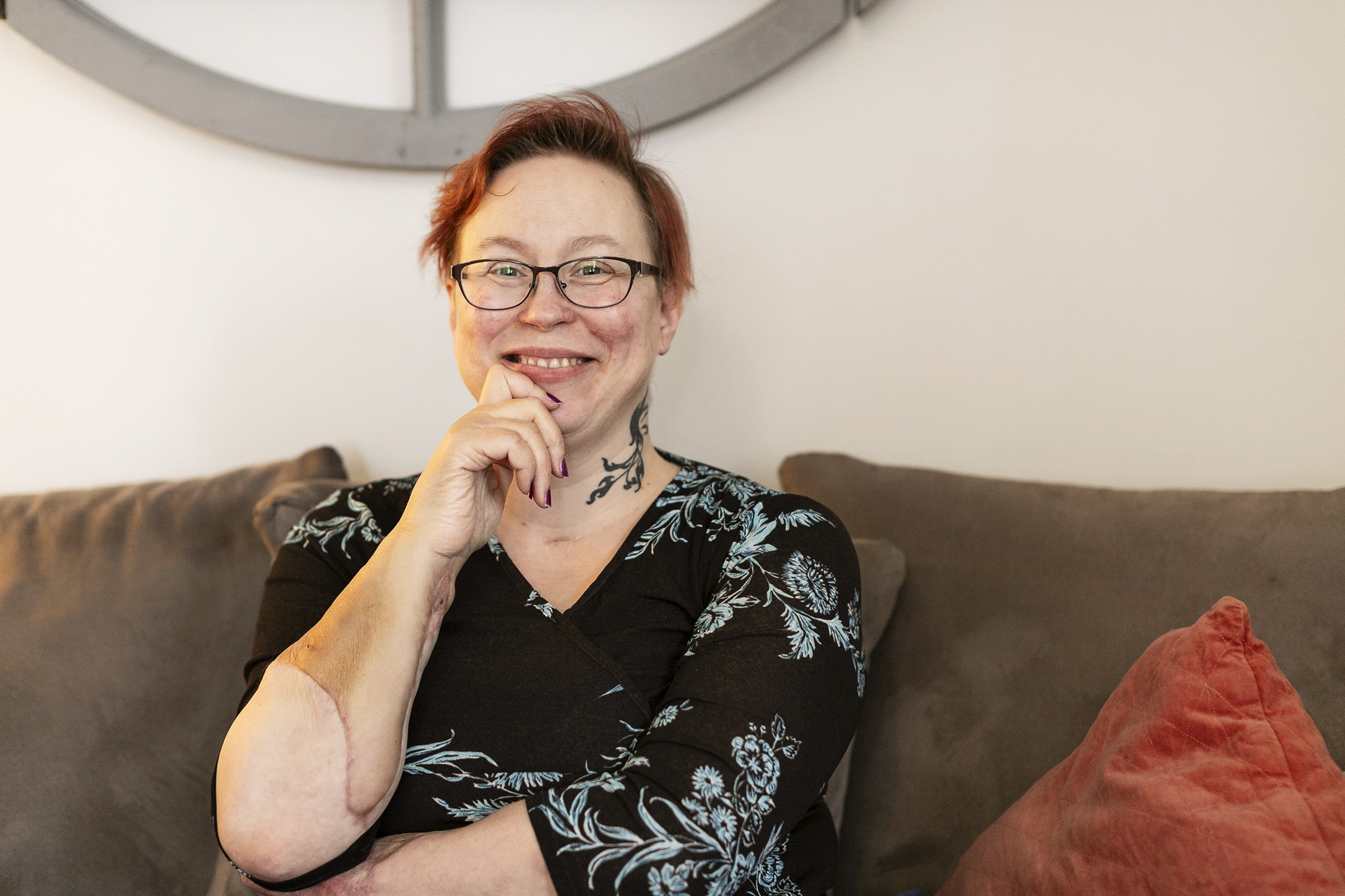 Arjalle siirrettiin uusi käsi – ”Pystyn jo kirjoittamaan nimeni”