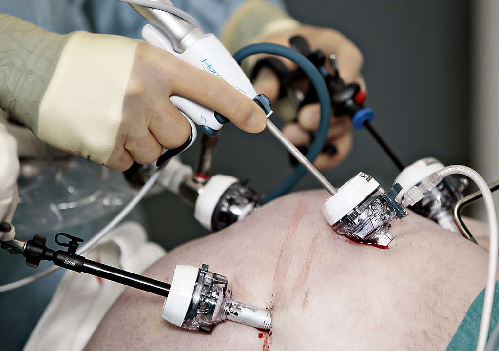 Vesa Koivukangas ja Timo Heikkinen tekevät laihdutusleikkausta 50-vuotiaalle oululaismiehelle. Mies toivoo pääsevänsä leikkauksen avulla eroon sokeritaudista. "Monilla leikatuilla diabetes on parantunut saman tien", Timo Heikkinen kertoo. Leikkaus maksaa itsensä takaisin, kun terveydenhuoltokäynnit lihavuuden liitännäissairauksien vuoksi vähenevät.