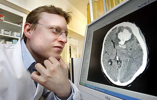 Neurokirurgi Sami Tetri tutkii tietokoneelta potilaan aivoverenvuotoa Oysissa. "Leikkaus auttaa potilasta valitettavan harvoin", hän sanoo.