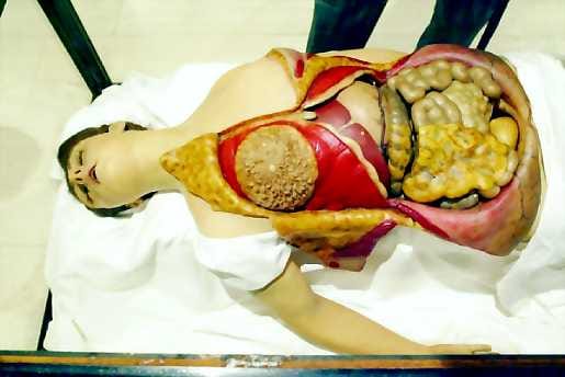 Anatomisesti purettava naisen ruumis Venus leikkauspöydällä Finlandia-talossa avautuvassa Anatominen Vahakabinetti näyttelyssä.