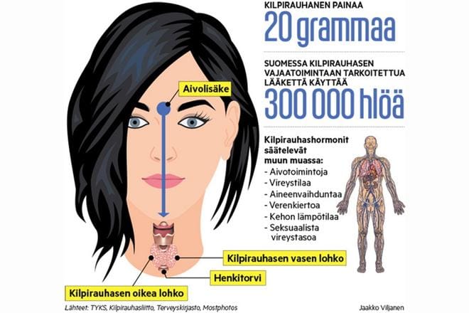 Vantaalaisella Lara Toivasella todettiin alakouluiässä kilpirauhasen vajaatoiminta.