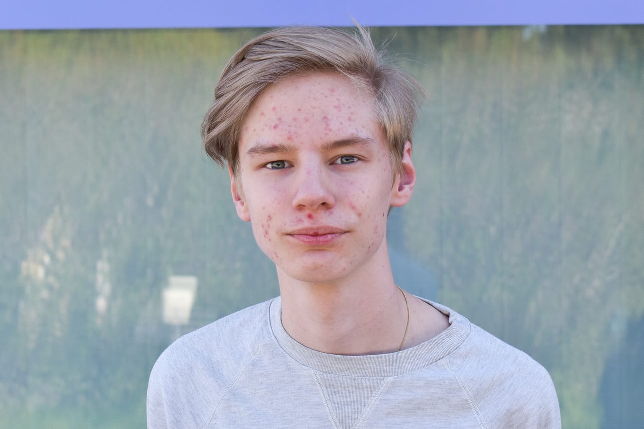 -