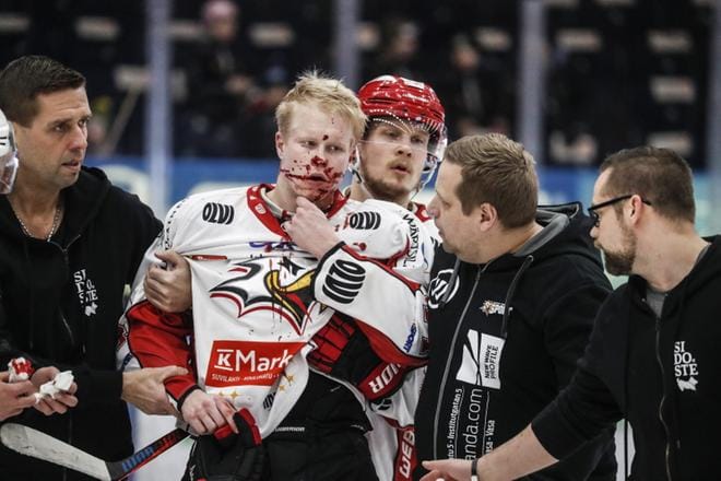 Sport-hyökkääjä Aleksi Ainalin loukkaantuminen säikäytti koko Hakametsän yleisön toisen erän alkajaisiksi. Ainali pystyi kuitenkin liukumaan tuettuna omin jaloin ulos kaukalosta maattuaan hetken kovan törmäyksen seurauksena tiedottomana jäällä.