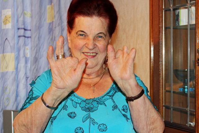Sonja Mäki-Ronkainen on pystynyt näillä sormillaan kutomaan sukkia ja tekemään kaikki kotityöt. Myönteisesti elämään suhtautuva on kohta 80-vuotias. KUVA: TARJA RIIHIMÄKI